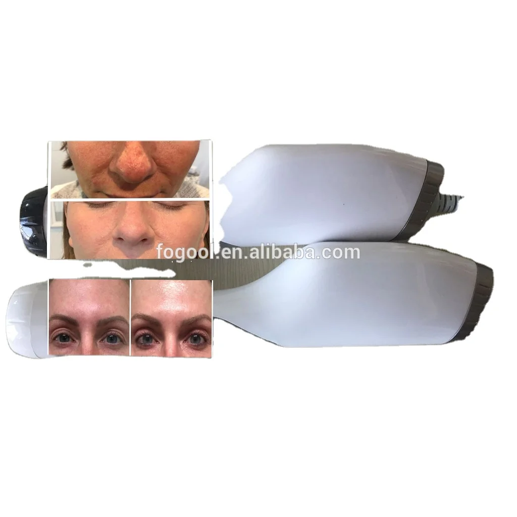 
Face Sterilization Plexr 3 in 1 Plasma Pen 