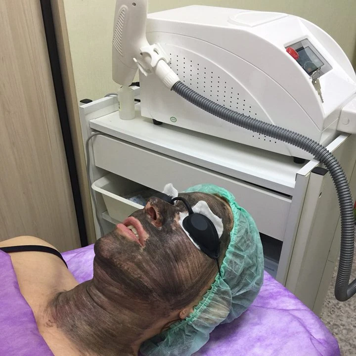 Multifunctional Laser Nd Yag Beauty Skin Whitening Ipl Opt Hair Removal Machine