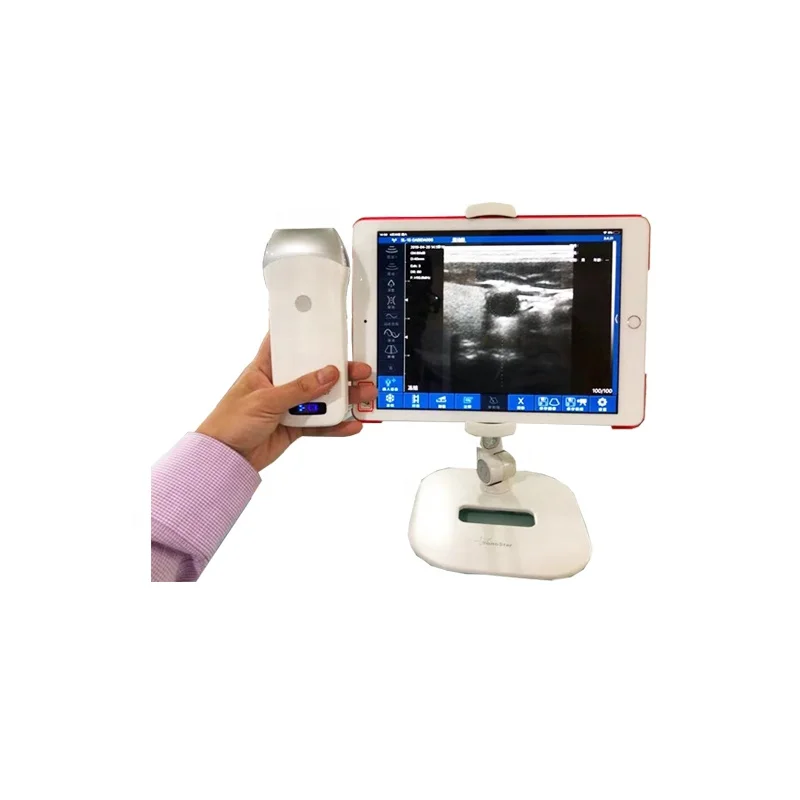 HD USB 5.5mm 720P HD Visual Endoscope Mini WIFI Control Eer Otoscope Camera