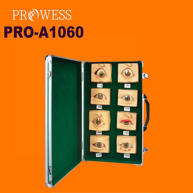 Pro-A1060 High quality cataract medical science anatomical Human Oculopathy Anatomical Medical cataract Eye Disease Model