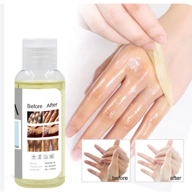 Private Label Extra Strong Peeling Knuckle Oil Whitening Yellow Peeling Oil