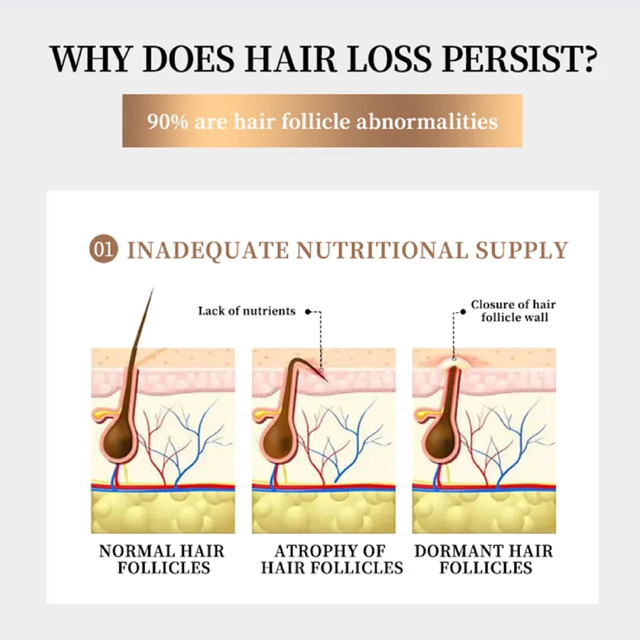 MULTI-PEPTIDE HAIR CARE ESSENCE 30mL Thicker Natural Organic Bald Treatment Anti Hair Loss Hair Growth Serum