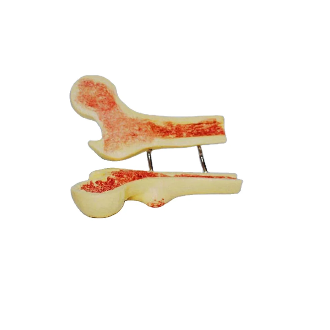 2021 new listing made of durable materials dedicated to teaching osteoporosis skeleton model