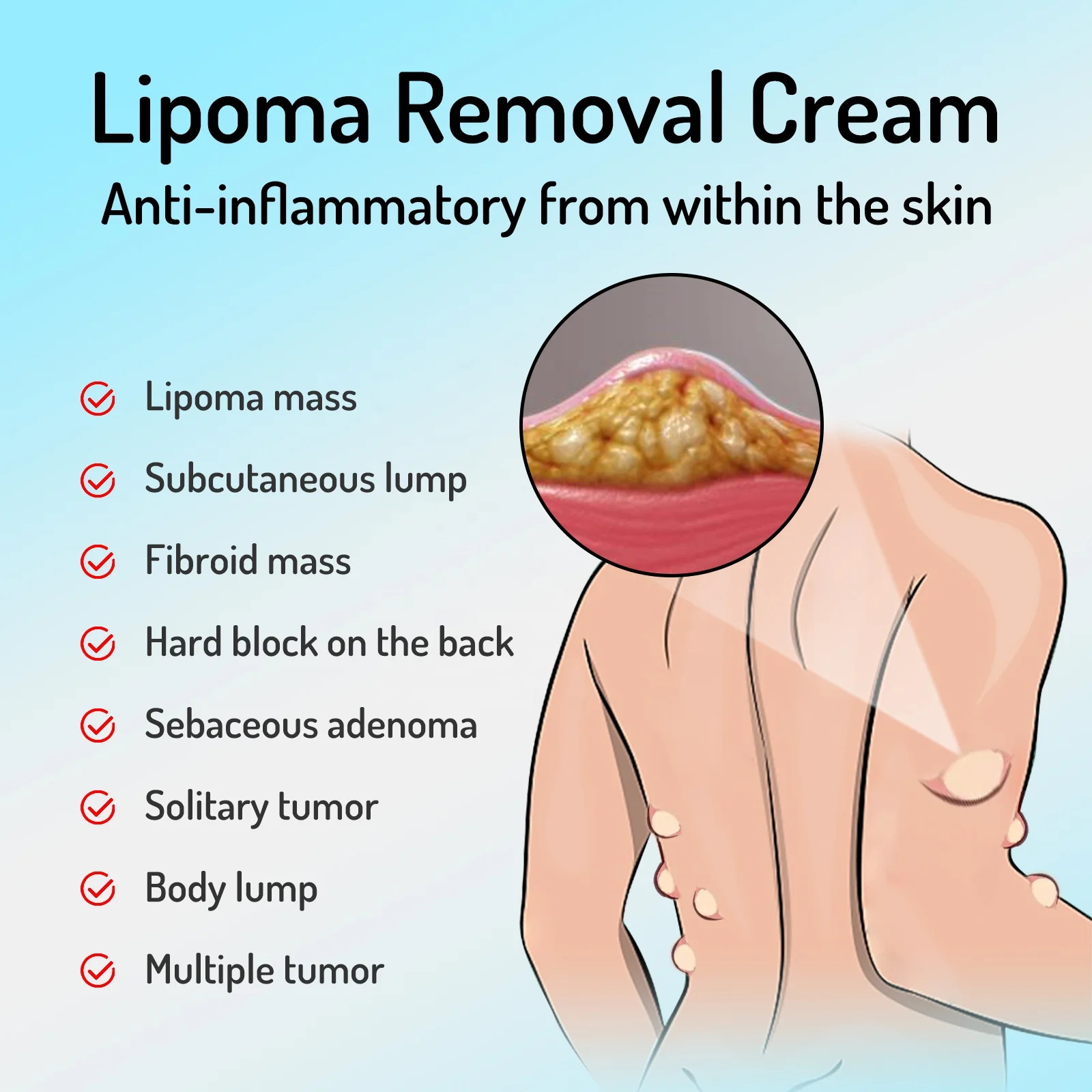 Hot Sale Free Shipping Lipoma Fat Removal Cream Good Price