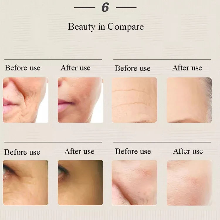 RF Eye Massage Beauty Device Heat Eye Care Remove Wrinkle Dark Circles Electric Eye lip Massager Pen