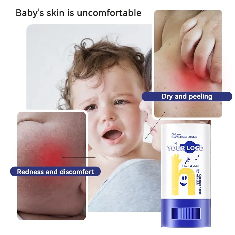 OEM Custom Baby/Infant Skin Whitening & Lightening Lotion with Coconut Horse Oil Stick Beauty & Personal Care Product