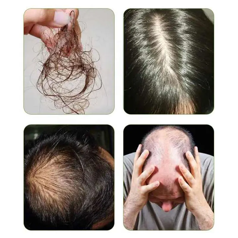 Bulk Supply Chebe Powder Chebe Powder for Hair Growth