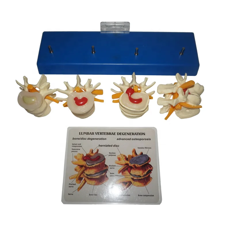 
R020704 Human Spine Lumbar Medical Anatomy Skeleton Model 