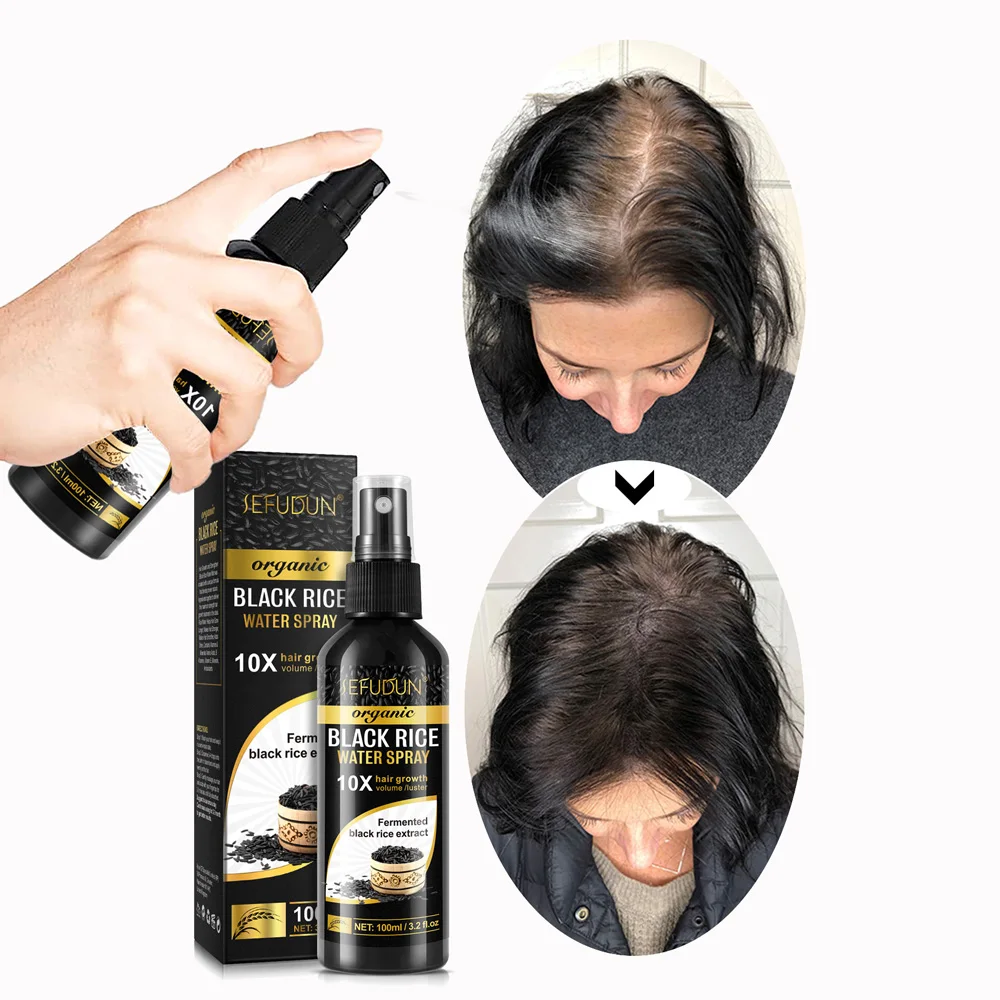 Fast Grow Hair Treatment Hair Loss Care Spray Biotin Black Rice Water Hair Growth Spray Serum For Men Women 100ml