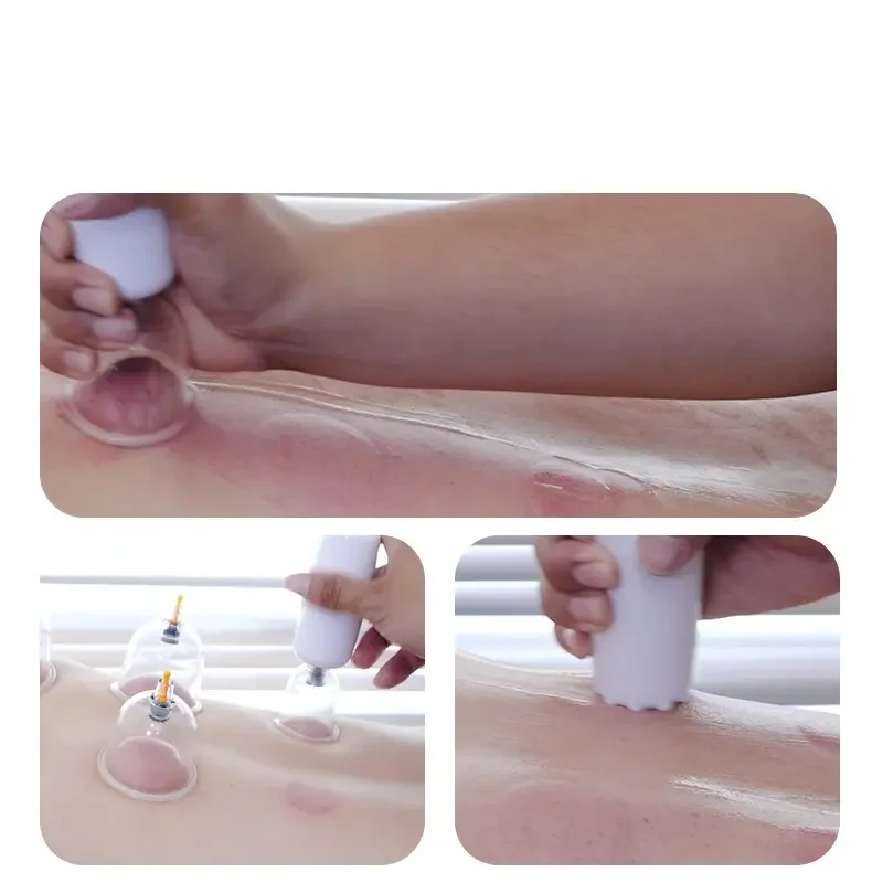 12pcs/set Healthful Electric Portable Cupping Device Light Weight Vacuum Cupping Set for Whole Body