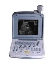 High quality portable ultrasound machine price portable ultrasound machine color doppler portable ultrasound machine price