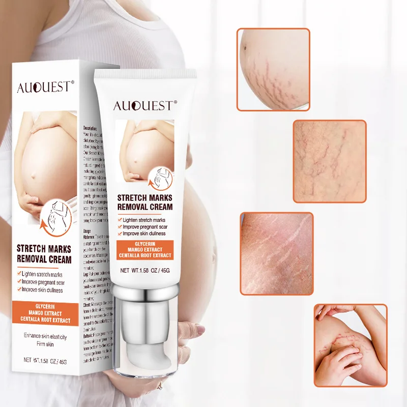 Glycerin Lightening Stretch Marks Improve Dullness Lifting Firming 45g Stretch Mark Cream