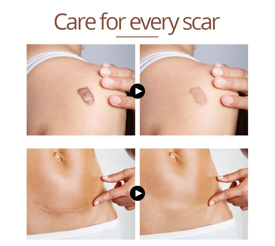 VIBRANT GLAMOUR Crocodile Repair Scar Anti -Wrinkle Moisturizing Whitening Shrink Pores Aging Face Cream