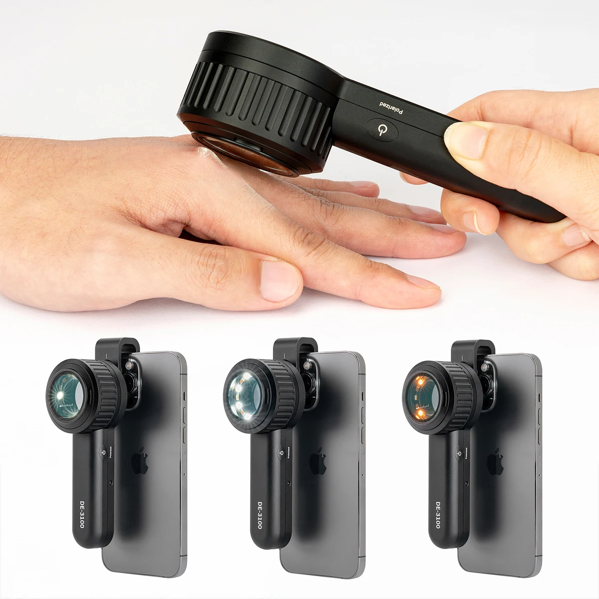 IBOOLO DE-3100 Handyscope смартфон мобильный дерматоскоп дермоскоп трихоскоп