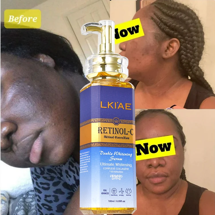 LKIAE 180ml glow boost luster whitening vegan retinol anti aging smoothing skincare collagen 5 in 1 facial serum