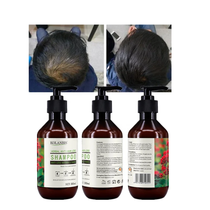 KOLANBIS Biotin Shampoo Strengthen Hair Follicles Hair Care Line Treatment Hair Growth