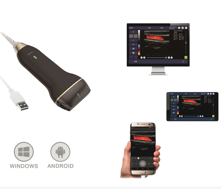 Healson C30 линейный Портативный Цветной Допплер USB смартфон ультразвуковой аппарат