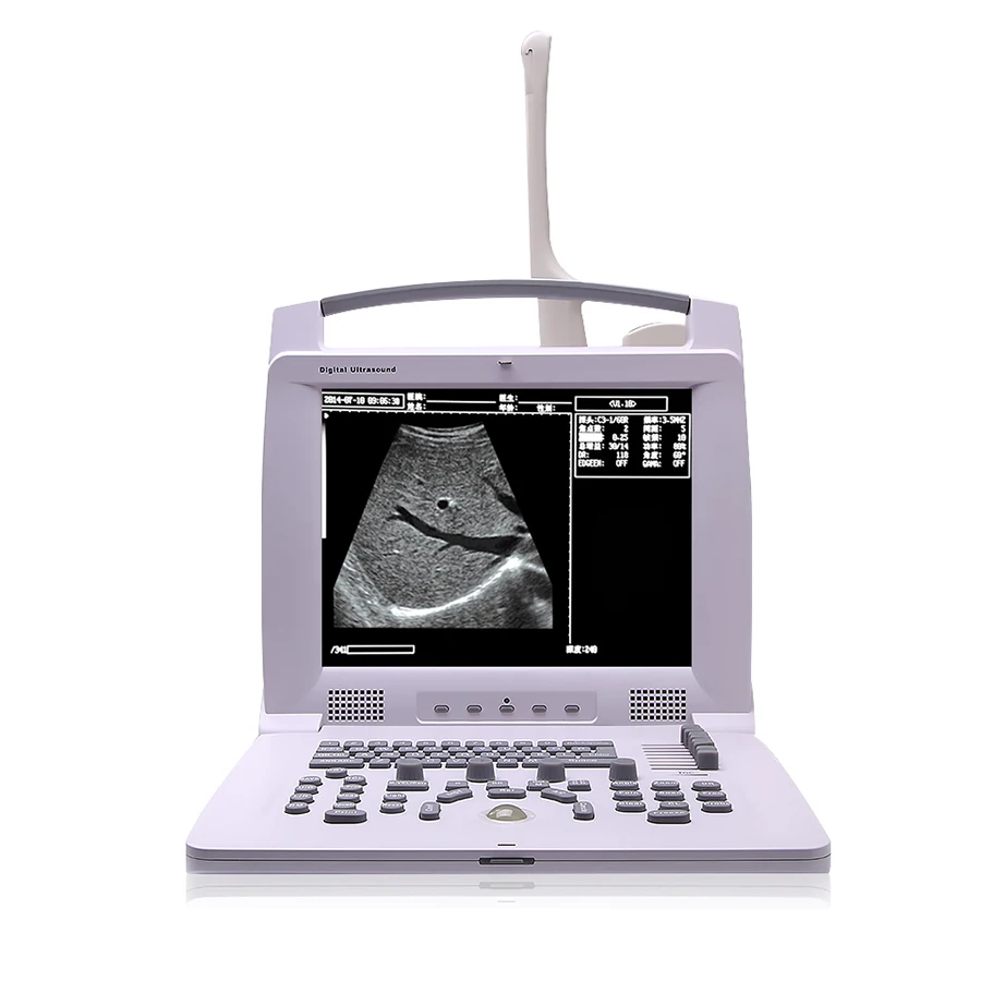 Black/white Full Digital Portable Trolley  Ultrasound Scanner Doppler Laptop echographe usg portatil machine Diagnostic System