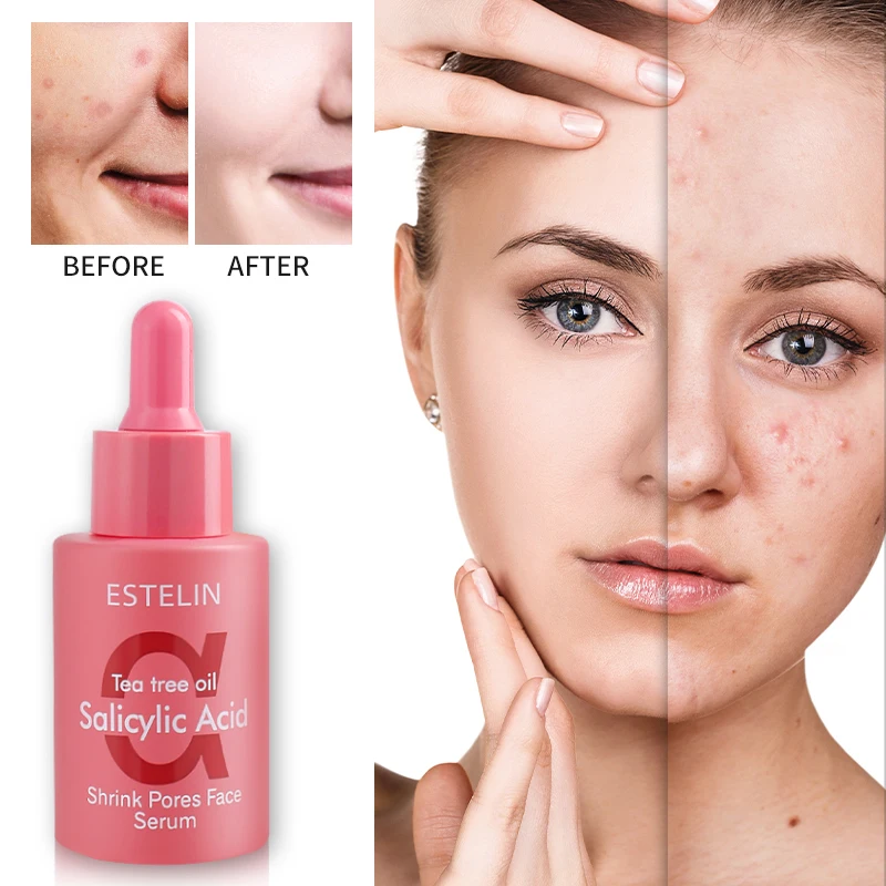ESTELIN  Salicylic acid&Tea tree oil  shrink pores face serum