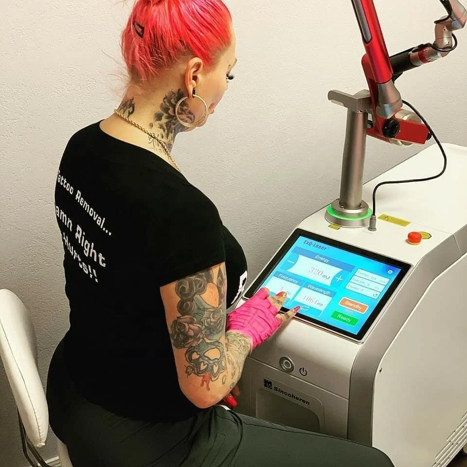 Non Invasive Pico Q-Switched ND YAG Laser Tattoo Removal 1064 532 Eyebrow Rejuvenation Skin Carbon Peeling