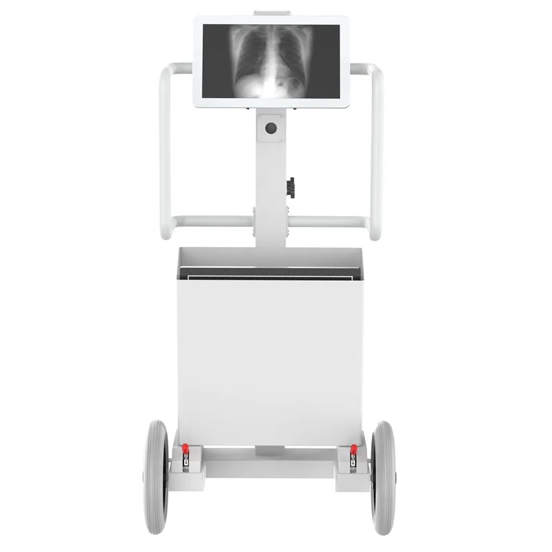5KW 100mA  High frequency mobile xray machine Digital radiography  X-ray equipment