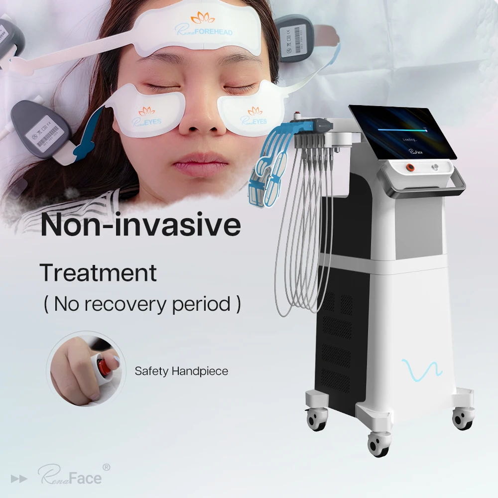 Renaface Radio Frequency Electromagnetic Face Muscle RF Lifting Facial Sculpting Machine Price