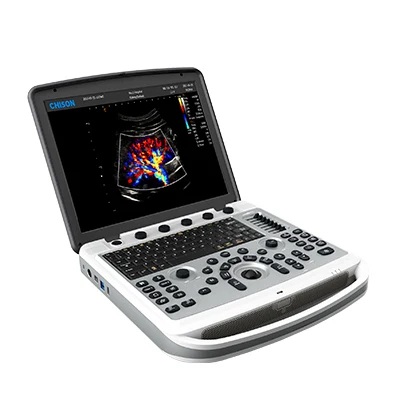 Chison Portable SonoBook 6 & Smart Laptop with Premium Performance