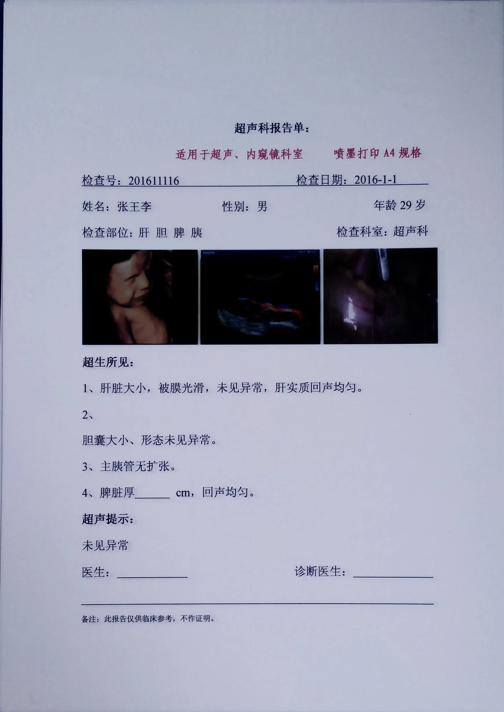 Ultrasound Imaging Output White Medical X-Ray Film Single Side Inkjet Medical Film