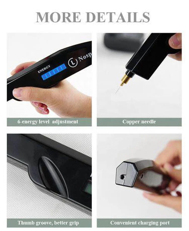 Smart handheld plasma pen for spot and warts removal and small tattoo removal