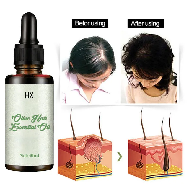 Growth Oil Private Label Serum Treatment Oils for Hair Spray Fast Organic Repair Grow Hair Loss Products