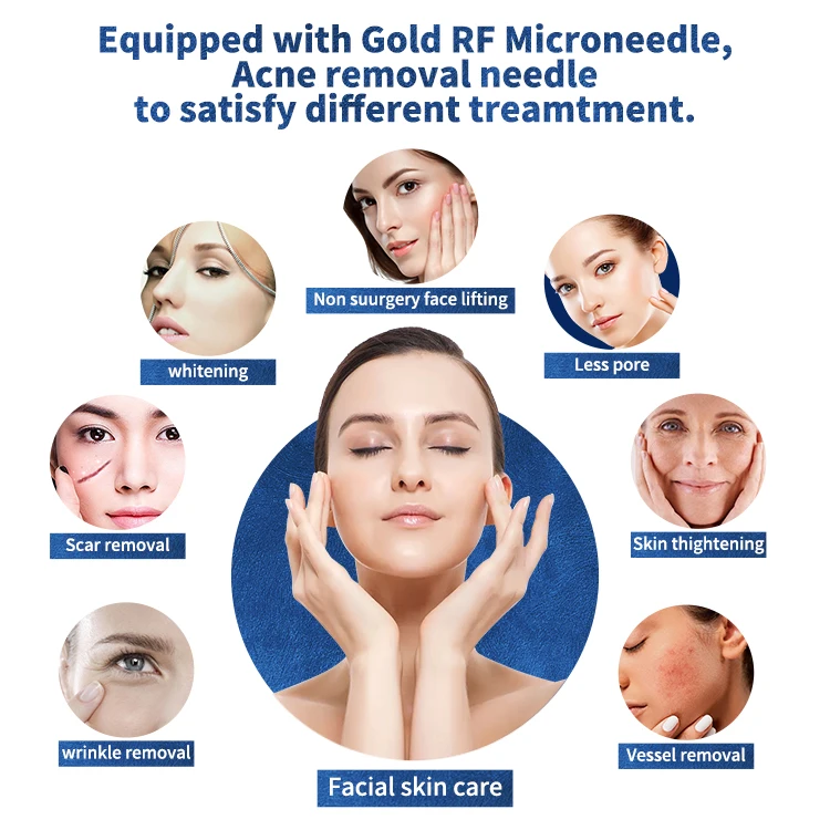 Горячие продукты Топ 20 2021 rf micro needling портативный фракционный радиочастотный микроизолирующий аппарат/rf машина для подтяжки кожи