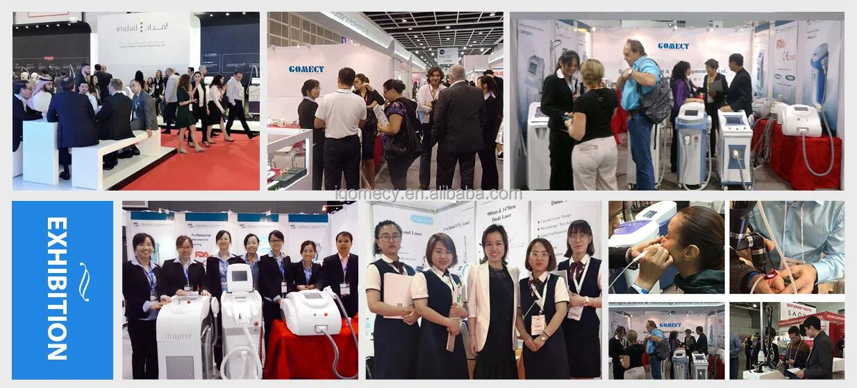 Best-selling-808nm-1064nm-diode-laser-hair-removal-machine-painless-spots-treatment-machine-K16-808