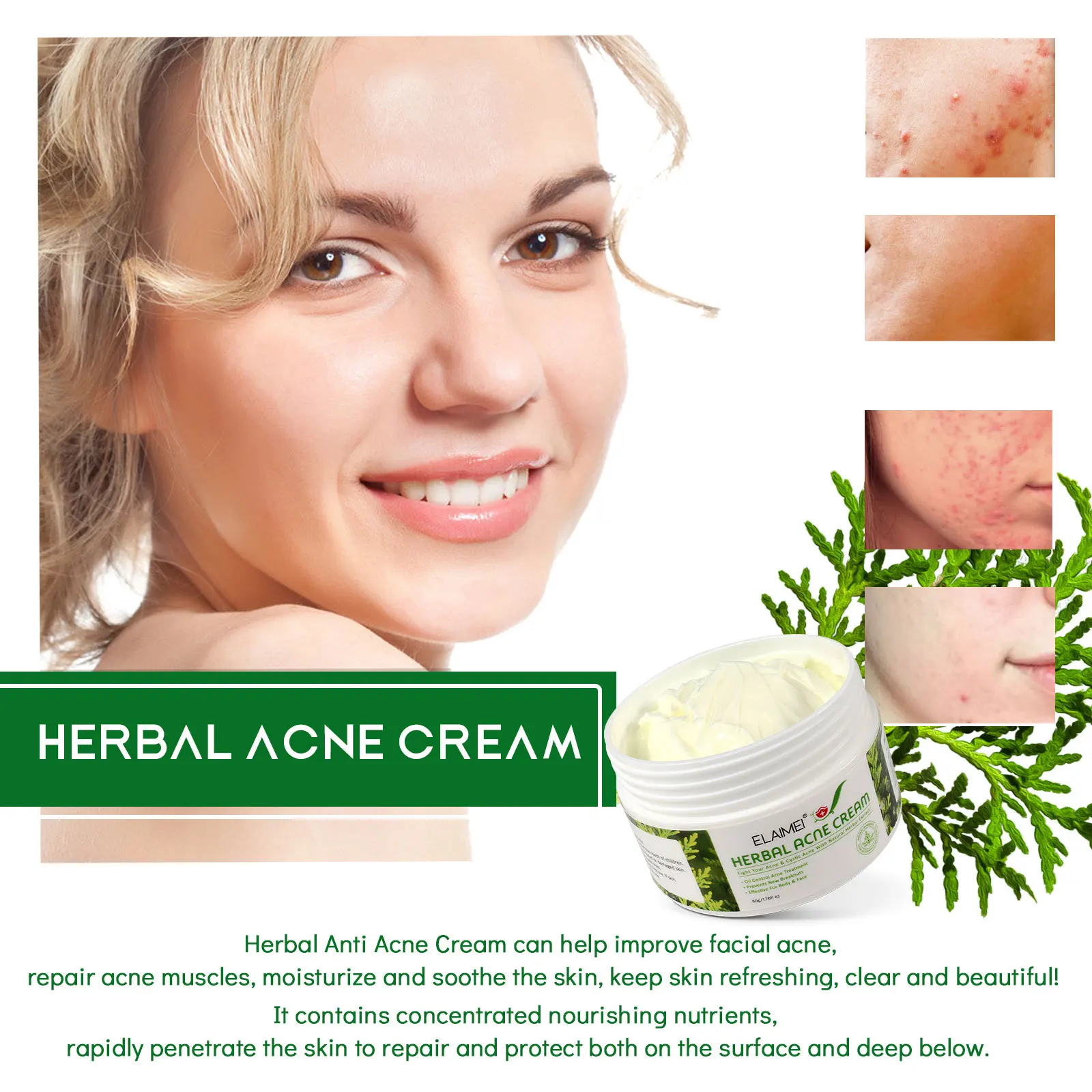 Private Label Natural Herbal Acne Repair Cream Beauty Effective For Face Body Oil Control Acne Treatment Cream