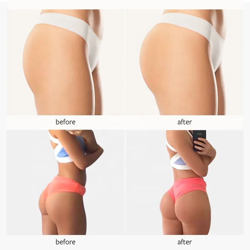 
Best Seller Wholesale Hips And Bums Buttock Enlargement Cream For Women 