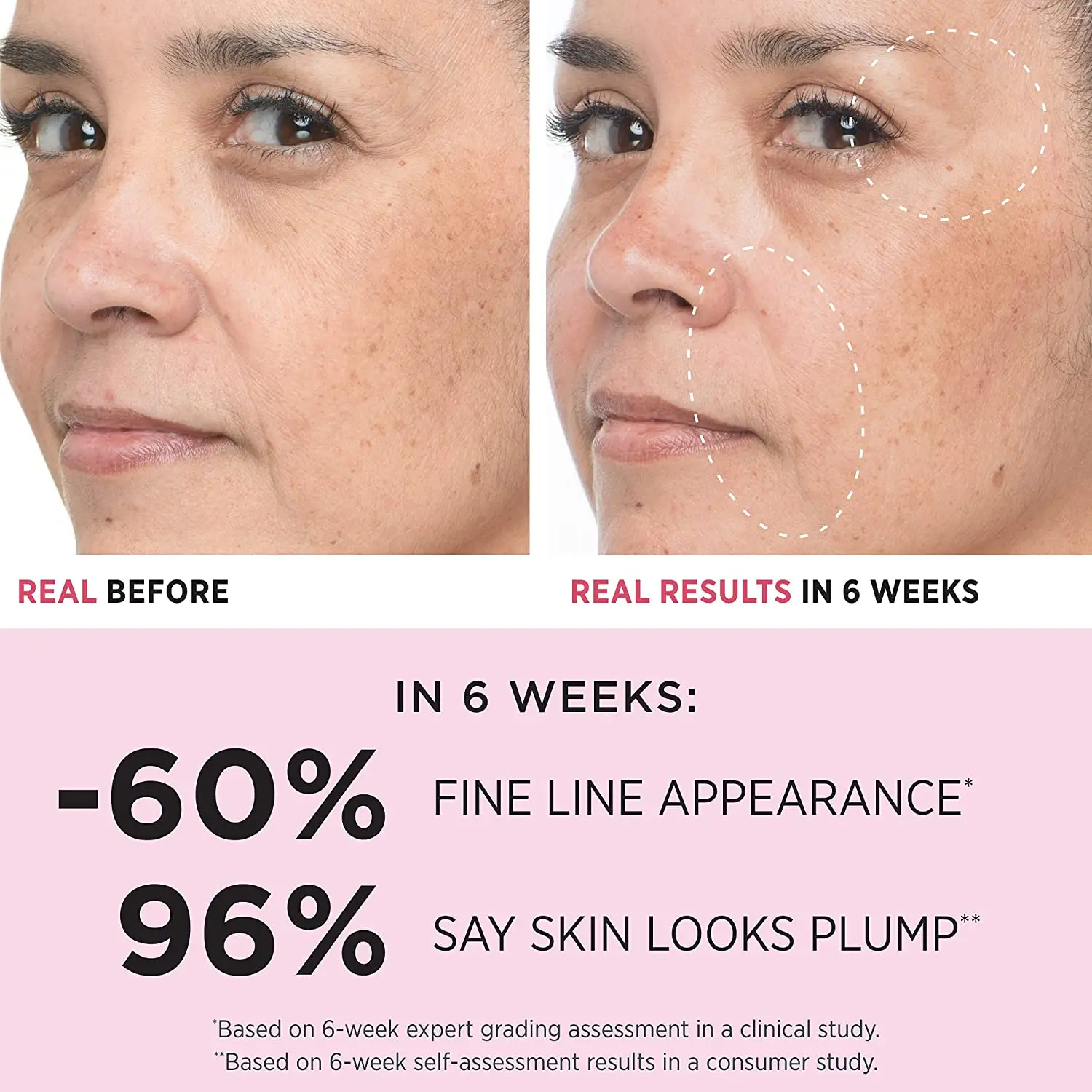 2022 Private Label  Bye Bye Lines  Vitamin C Serum For Face With 1.5% Hyaluronic Acid Serum