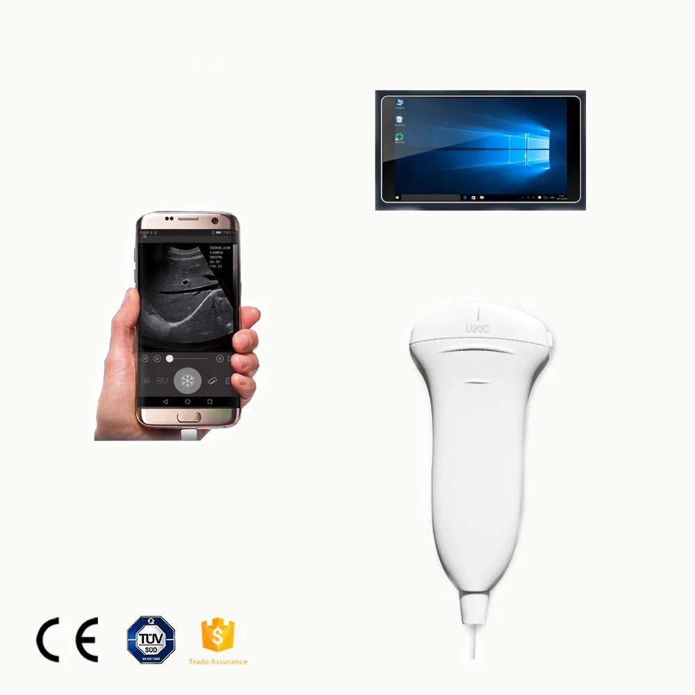 GYGN-CE/ISO U20C выпуклая USB цифровая портативная ультразвуковая машина для ICU/живота
