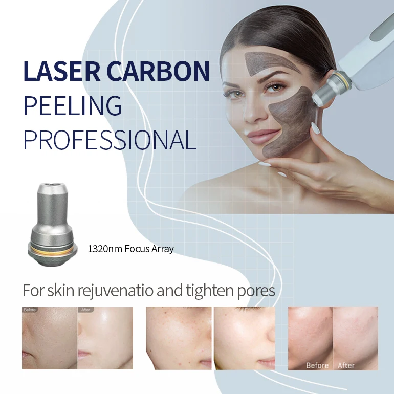2022 Chinese supplier high frequency 4 wave q switch nd yag laser tattoo removal machine