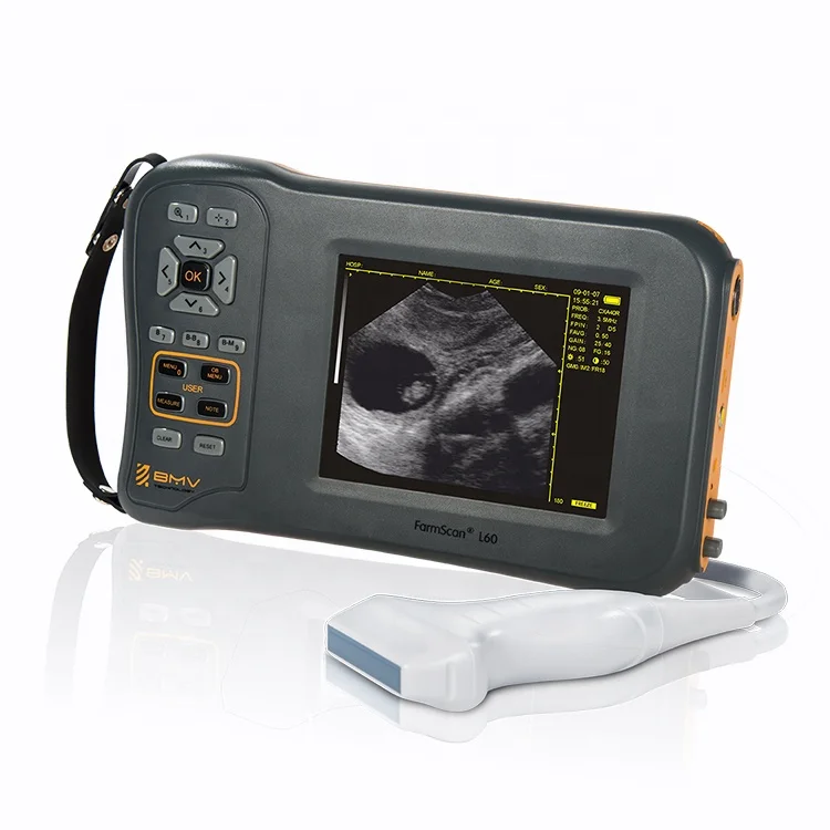 Best-Selling FarmScan L60 Portable Veterinary Ultrasound Scanner for Cattle Sheep Pregnancies