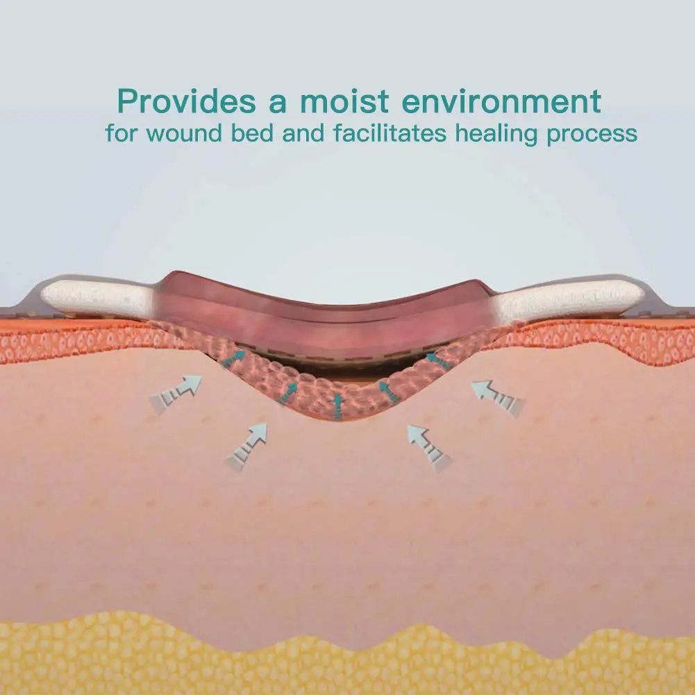 High quality For Foot Ulcer Wound Dressing Hydrofiber Alginate Dressing