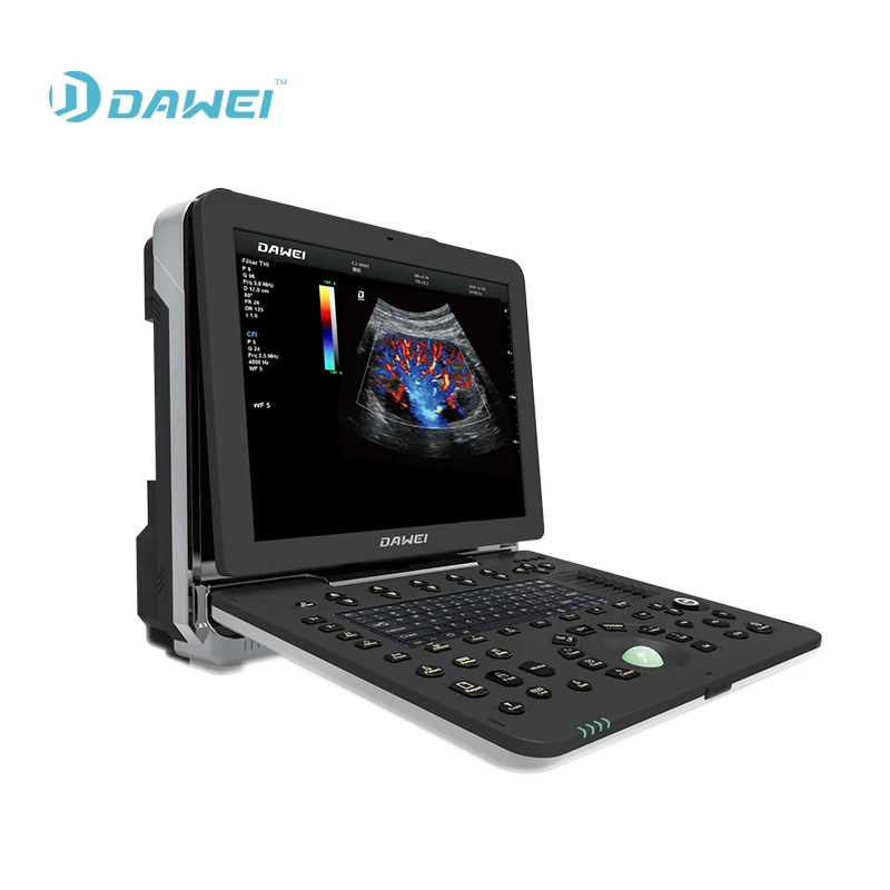 Portable cardiac ultrasound scanner color doppler ultrasound machine
