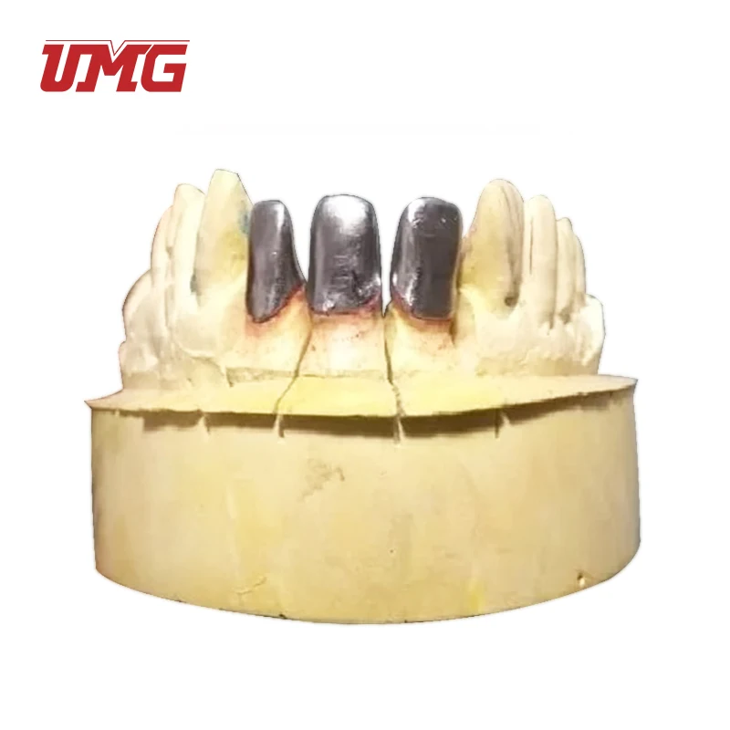 Dental Lab Metal Materials Ceramic Nickel Chrome Dental Alloy Beryllium Free