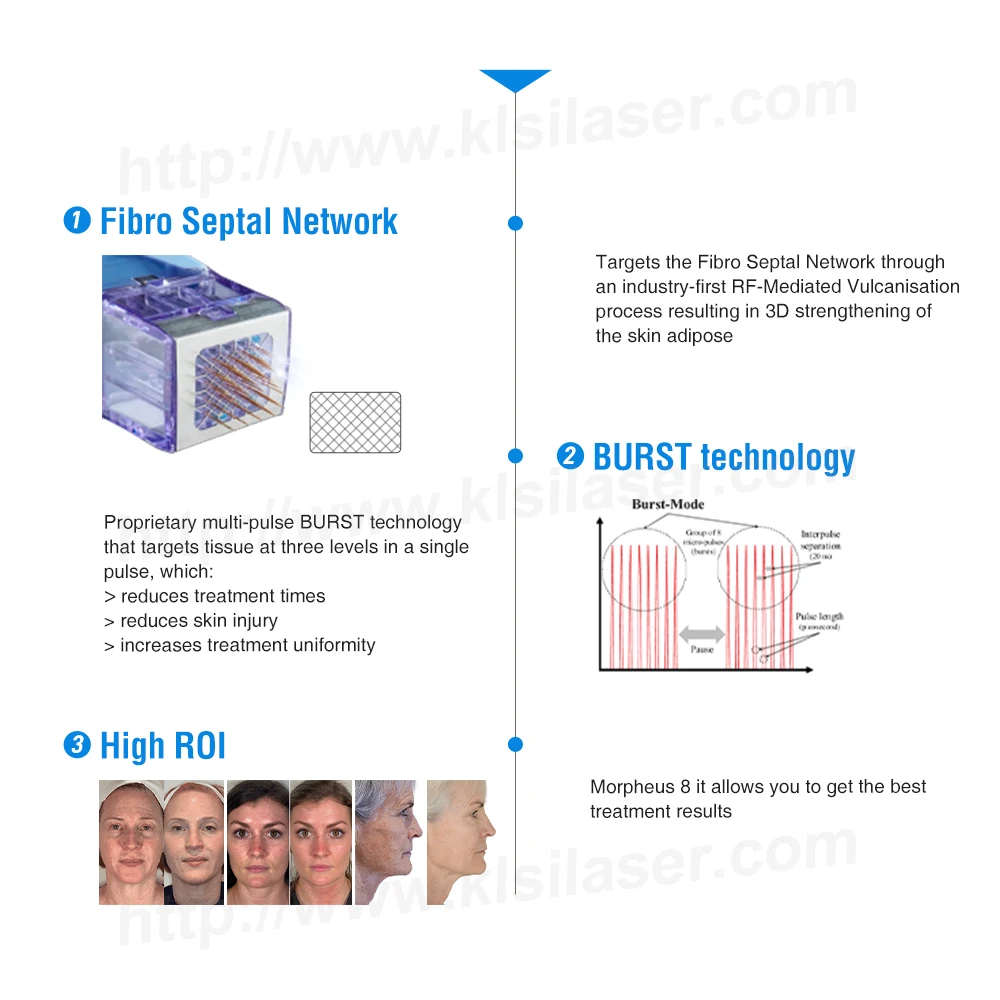 KLSI Ce Approved !  rf microneedling machine morpheus8