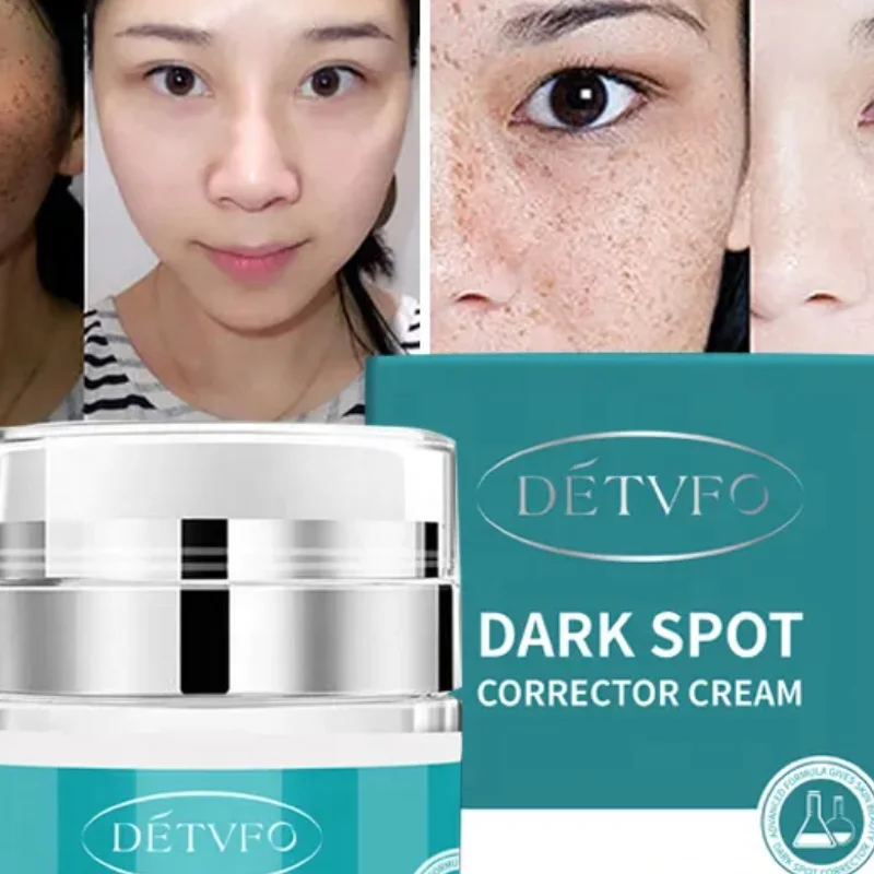 Oem Private Label White Gold Skin Whitening Face Dark Spot Corrector Anti Freckle And Freckle-Removing Cream