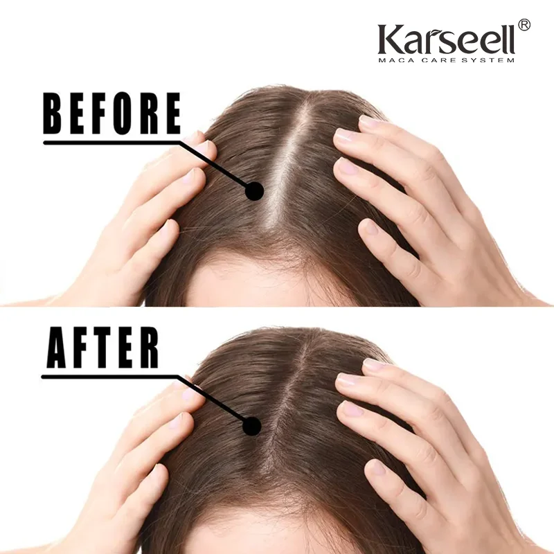 Karseell Hot Sale Product Private Label Pure Plant  Hair Argan Oil Morocco Body Care High Quality Hair Treatment Growth Oil