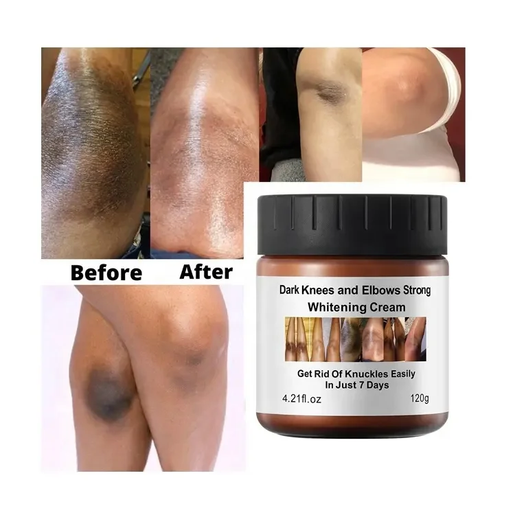 OEM ODM Organic Body Care Product Dark Knees And Elbows Strong Whitening Cream Customized Private Logo