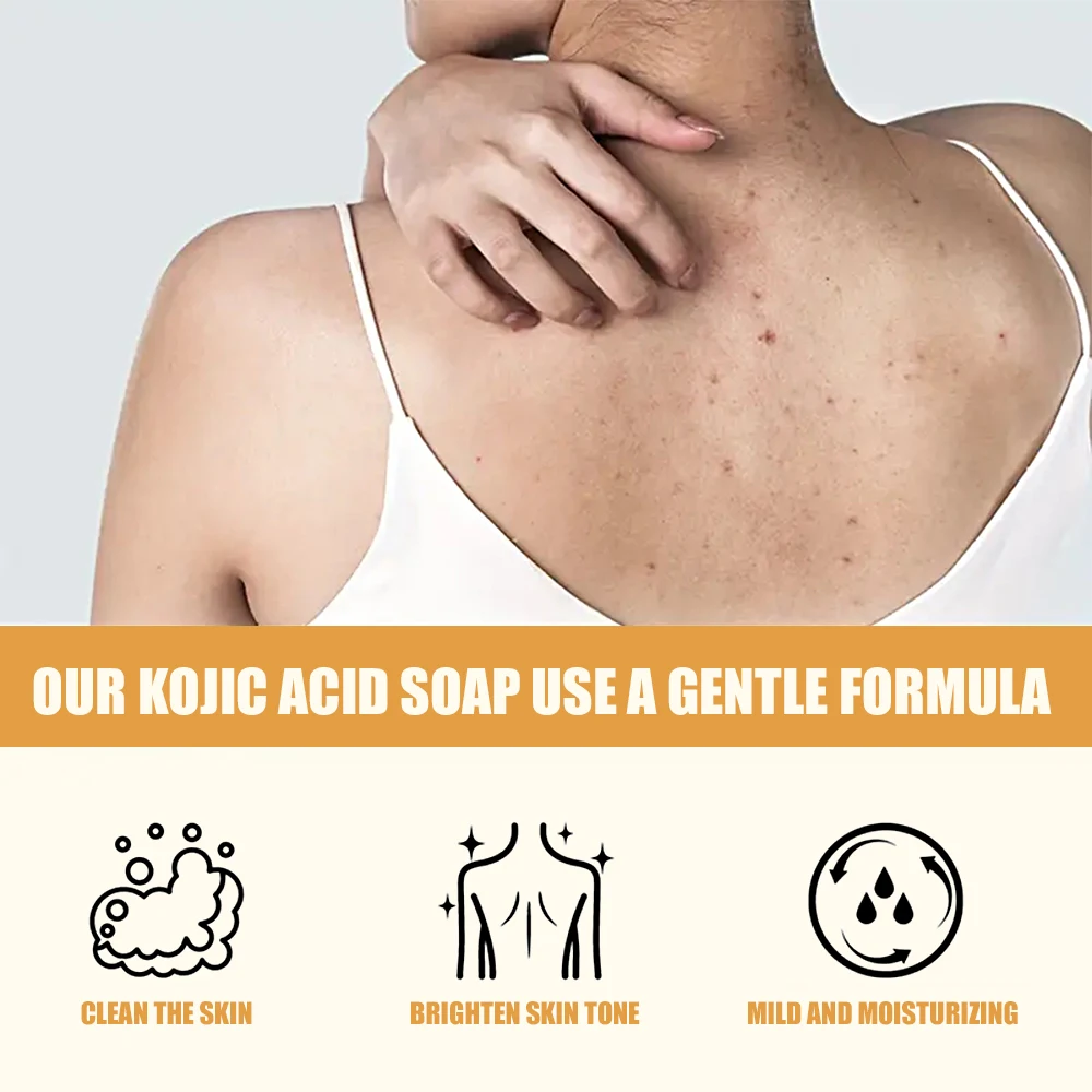 Factory Price Handmade Skin Care Aloe Argan Oil Refresh Acne Pore Pimple Treatment Sandalwood Kojic Acid Soap For Body And Face