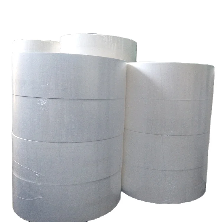 China Northern Soft Wood Untreated Fluff Pulp Unbleached Packaging Paper Pulp Diaper Manufacturer 416A-7