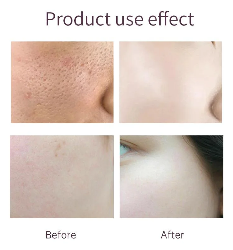 2021 HOT Selling the ordinary aha 30% bha 2% peeling solution Anti Acne Remove blackheads Smooth skin aha serum