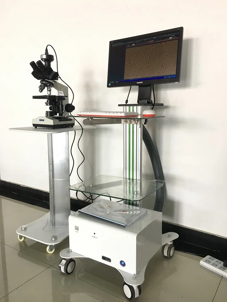 Высококачественный анализатор спермы качества для продажи