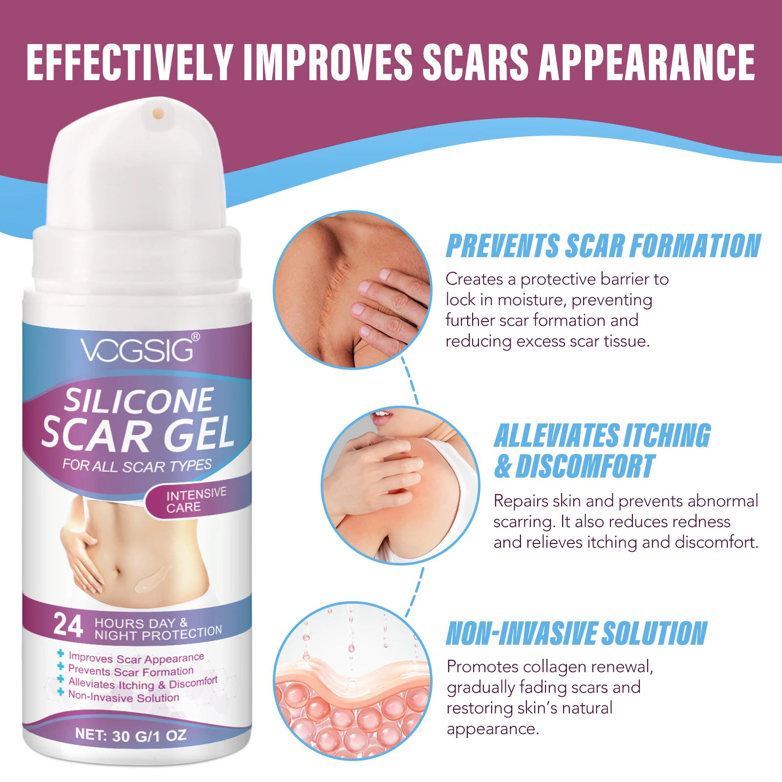 Best Selling Skin Care Scar Removal Gel Premium Face Body Pimples Acne Remove Scar Remover Gel for All Scar Type
